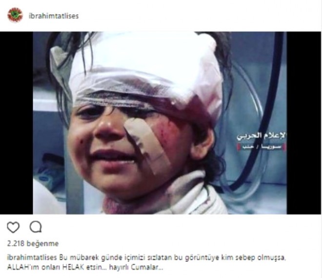Suriyada yaralanan qız İbrahim Tatlısəsə üsyan etdirdi - video