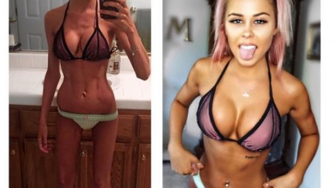 22 yaşlı model ölümcül xəstəliyə qalib gəldi