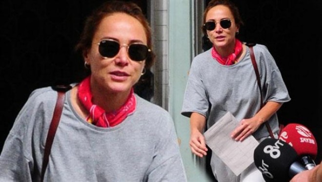 Burçin Terzioğlu botoks iddialarına cavab verdi