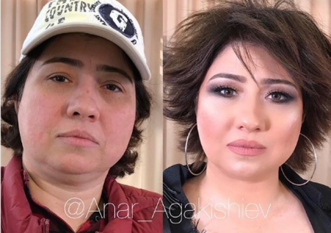 Aygün Bəylər dəyişib belə oldu - foto