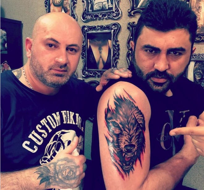 Vüqar Muradov qoluna döymə vurdurub