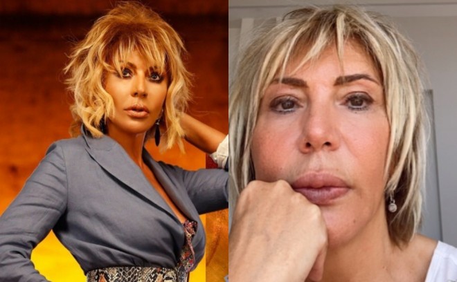 "Virusa yoluxdunuzsa, təşvişə düşməyin" - Xalq artisti