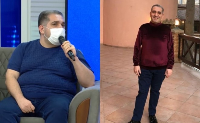 Nurlan əməliyyatdan sonra 33 kilo arıqlayıb - foto