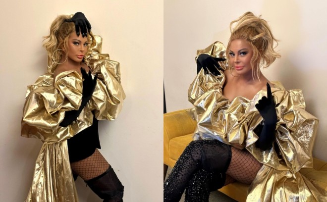 Xalq artisti səhnəyə qara şort ilə çıxıb - foto