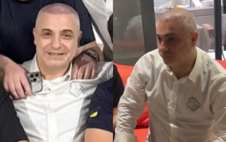 Rüfət saç əkdirib